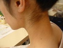 左側・お手入れ2ヵ月後