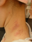 左側・お手入れ前